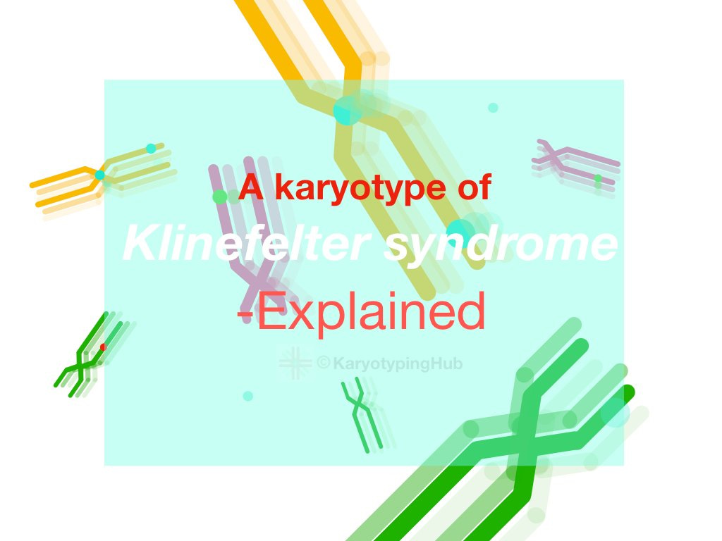 A karyotype of Klinefelter Syndrome- Explained – KaryotypingHub