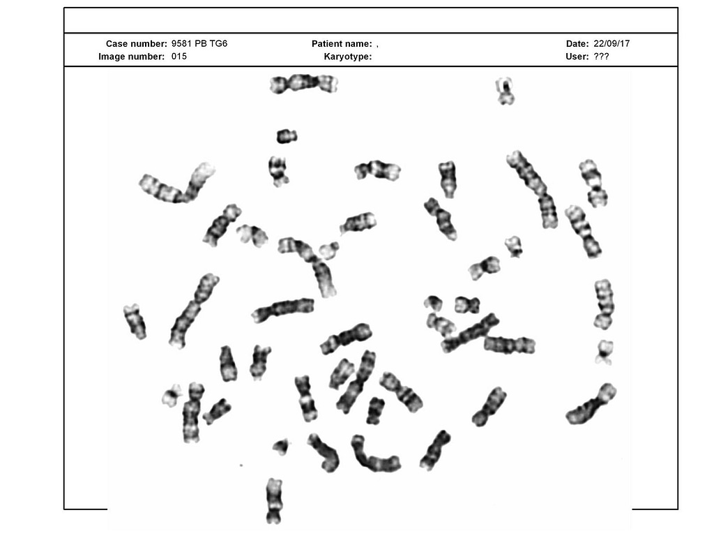 The karyotype image 