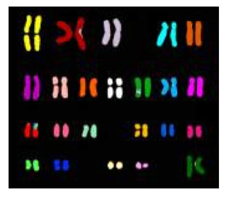 The image of spectral karyotyping. 