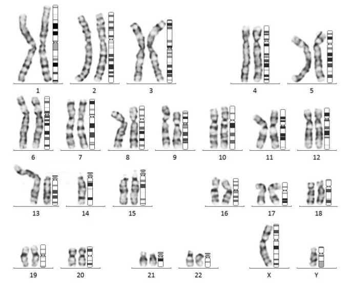 Human karyotype with X and Y chromosomes